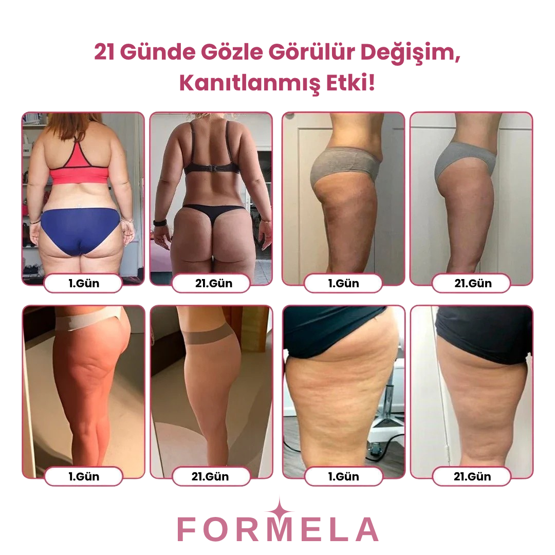 Yağ Yakıcı ve Sıkılaştırıcı Korse