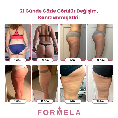 Yağ Yakıcı Şort Korse